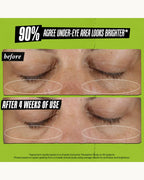 Kiehl’s Creamy Eye Treatment with Avocado